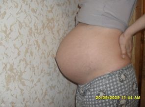 НАМ 37 НЕДЕЛЬ .