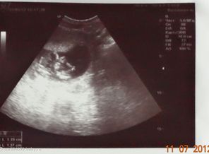 31.05.12_13_weeks
