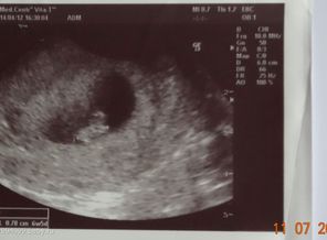 14.04.12_6_weeks_5_days