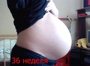 я