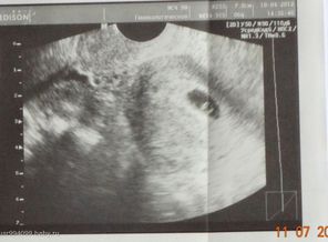 10.04.12_5_weeks_5_days